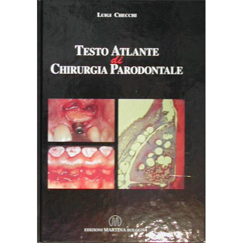 Testo atlante di chirurgia parodontale